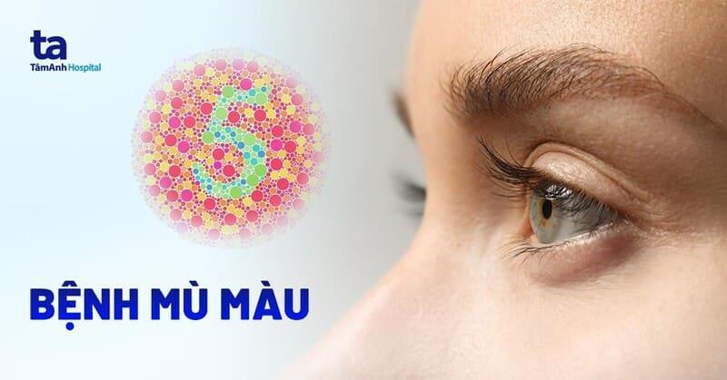 Một bảng màu với các màu vàng, nâu, trắng, xám, ghi được đánh dấu là hợp, và các màu đỏ, hồng, tím được đánh dấu là kỵ, có thể thêm màu xanh lá cây ở mức trung bình và xanh dương, đen ở mức cẩn trọng